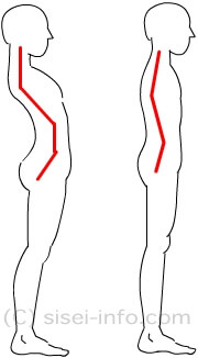 背筋の伸びた姿勢と胸を張った姿勢比較